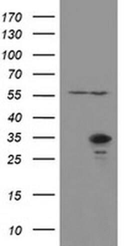 RBPMS Monoclonal Antibody (OTI1F9), TrueMAB , OriGene 100 &mu;L; Unconjugated:Antibodies,