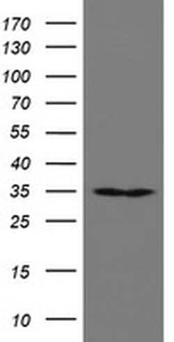 RBPMS Monoclonal Antibody (OTI3D10), TrueMAB , OriGene 100 &mu;L; Unconjugated:Antibodies,