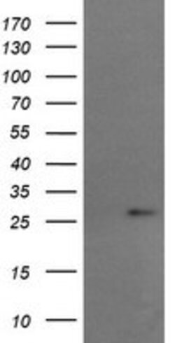 RCAN3 Mouse anti-Human, Clone: OTI1B2, lyophilized, TrueMAB 100 &mu;g;