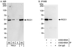 RCC1 Rabbit anti-Human, Polyclonal, Bethyl Laboratories 100 &mu;L; Unconjugated:Antibodies,