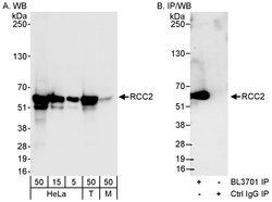 RCC2 Rabbit anti-Human, Mouse, Polyclonal, Bethyl Laboratories 100 &mu;l;