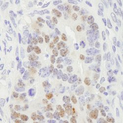 RCC2 Polyclonal Antibody, Bethyl Laboratories 10 &mu;L | Buy Online | Bethyl Laboratories, Inc | Fisher Scientific