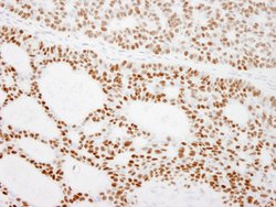 RCC2 Polyclonal Antibody, Bethyl Laboratories 10 &mu;L | Buy Online | Bethyl Laboratories, Inc | Fisher Scientific
