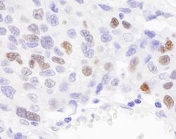 RCH1/KPNA2 Rabbit anti-Human, Polyclonal, Bethyl Laboratories 100 &mu;L;