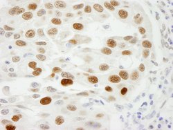 RCH1/KPNA2 Polyclonal Antibody, Bethyl Laboratories 10 &mu;L; Unconjugated:Antibodies,