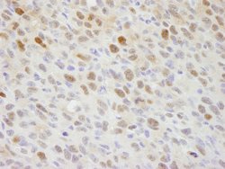 RCH1/KPNA2 Polyclonal Antibody, Bethyl Laboratories 10 &mu;L; Unconjugated:Antibodies,