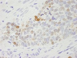 RCH1/KPNA2 Polyclonal Antibody, Bethyl Laboratories 10 &mu;L; Unconjugated:Antibodies,