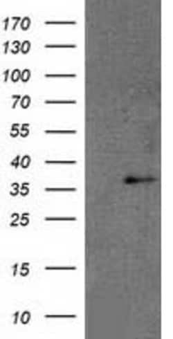 RDH14 Mouse anti-Human, Clone: OTI3E1, lyophilized, TrueMAB 100 &mu;g;