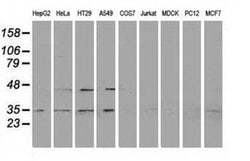 RDH14 Monoclonal Antibody (OTI4G8), TrueMAB , OriGene 100 &mu;L; Unconjugated:Antibodies,