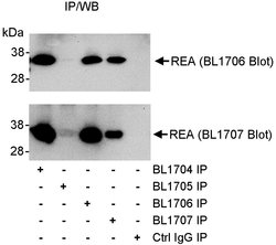 REA Rabbit anti-Human, Polyclonal, Bethyl Laboratories 10 &mu;L; Unconjugated:Antibodies,