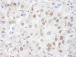 REA Polyclonal Antibody, Bethyl Laboratories 100 &mu;L; Unconjugated:Antibodies,