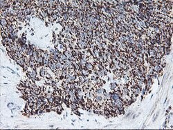 REEP2 Mouse anti-Human, Clone: OTI2C7, lyophilized, TrueMAB 100 &mu;g;