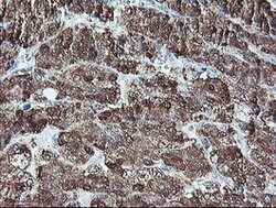 REEP2 Mouse anti-Human, Clone: OTI2C7, lyophilized, TrueMAB 100 &mu;g;