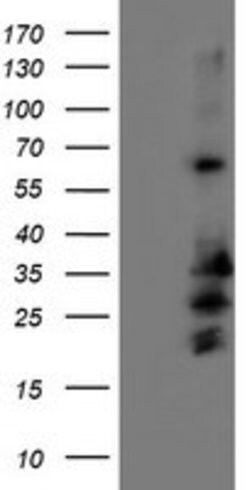 REEP2 Mouse anti-Human, Clone: OTI2C7, lyophilized, TrueMAB 100 &mu;g;