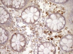 REN Monoclonal Antibody (OTI1D3), TrueMAB , OriGene:Antibodies:Primary