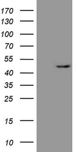 REN Monoclonal Antibody (OTI1D3), TrueMAB , OriGene:Antibodies:Primary