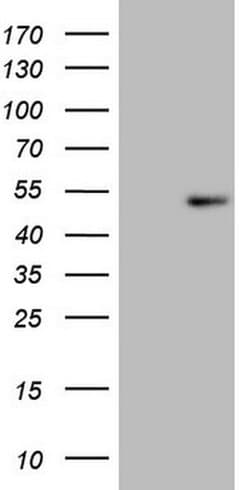 REN Monoclonal Antibody (OTI2B9), TrueMAB , OriGene:Antibodies:Primary