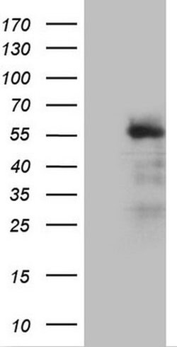 REN Monoclonal Antibody (OTI3E4), TrueMAB , OriGene:Antibodies:Primary