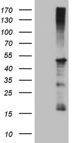 REN Monoclonal Antibody (OTI1A10), TrueMAB , OriGene 100 &mu;L; Unconjugated:Antibodies,