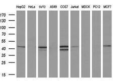 REN Monoclonal Antibody (OTI1A10), TrueMAB , OriGene 100 &mu;L; Unconjugated:Antibodies,