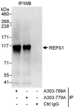 REPS1 Rabbit anti-Human, Polyclonal, Bethyl Laboratories 100 &mu;L | Buy Online | Bethyl Laboratories, Inc | Fisher Scientific
