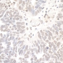 REST Rabbit anti-Human, Polyclonal, Bethyl Laboratories 10 &mu;L; Unconjugated:Antibodies,