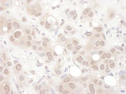 REST Rabbit anti-Human, Polyclonal, Bethyl Laboratories 100 &mu;L; Unconjugated:Antibodies,