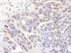 REST Polyclonal Antibody, Bethyl Laboratories 10 &mu;L; Unconjugated:Antibodies,