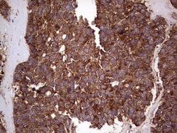 RET Monoclonal Antibody (OTI1G1), TrueMAB , OriGene 100 &mu;L; Unconjugated:Antibodies,