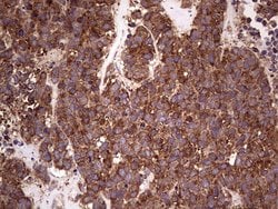 RET Monoclonal Antibody (OTI5C5), TrueMAB , OriGene 100 &mu;L; Unconjugated:Antibodies,