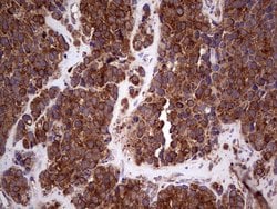 RET Monoclonal Antibody (OTI21H4), TrueMAB , OriGene 100 &mu;L; Unconjugated:Antibodies,