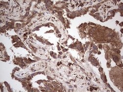 RET Monoclonal Antibody (OTI21H4), TrueMAB , OriGene 100 &mu;L; Unconjugated:Antibodies,