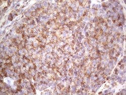 RET Monoclonal Antibody (OTI5F2), TrueMAB , OriGene 100 &mu;L; Unconjugated:Antibodies,