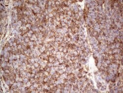 RET Monoclonal Antibody (OTI21H5), TrueMAB , OriGene 100 &mu;L; Unconjugated:Antibodies,