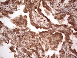 RET Monoclonal Antibody (OTI21H5), TrueMAB , OriGene 100 &mu;L; Unconjugated:Antibodies,