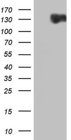RET Monoclonal Antibody (OTI2G6), TrueMAB , OriGene:Antibodies:Primary