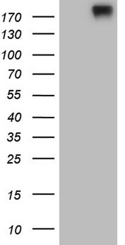 RET Monoclonal Antibody (OTI21H4), TrueMAB , OriGene:Antibodies:Primary