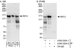 RFC1 Rabbit anti-Human, Polyclonal, Bethyl Laboratories 100 &mu;L; Unconjugated:Antibodies,