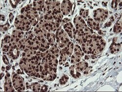 RFC2 Monoclonal Antibody (OTI2B2), TrueMAB , OriGene 30 &mu;L; Unconjugated:Antibodies,