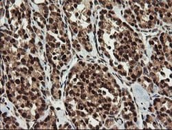 RFC2 Monoclonal Antibody (OTI2B2), TrueMAB , OriGene 30 &mu;L; Unconjugated:Antibodies,