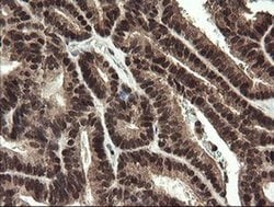 RFC2 Monoclonal Antibody (OTI2B2), TrueMAB , OriGene 30 &mu;L; Unconjugated:Antibodies,