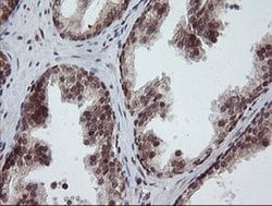 RFC2 Monoclonal Antibody (OTI2B2), TrueMAB , OriGene 30 &mu;L; Unconjugated:Antibodies,