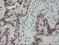 RFC2 Monoclonal Antibody (OTI5A1), TrueMAB , OriGene 100 &mu;L; Unconjugated:Antibodies,