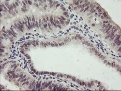 RFC2 Monoclonal Antibody (OTI5A1), TrueMAB , OriGene 100 &mu;L; Unconjugated:Antibodies,