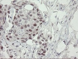 RFC2 Monoclonal Antibody (OTI5A1), TrueMAB , OriGene 100 &mu;L; Unconjugated:Antibodies,