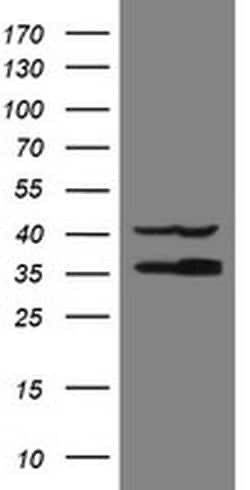 RFC2 Monoclonal Antibody (OTI4E1), TrueMAB , OriGene 30 &mu;L | Buy Online | Origene Technologies | Fisher Scientific
