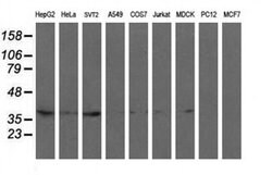 RFC2 Monoclonal Antibody (OTI4E1), TrueMAB , OriGene 30 &mu;L | Buy Online | Origene Technologies | Fisher Scientific