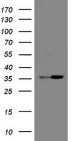 RFC2 Mouse anti-Human, Clone: OTI11C6, lyophilized, TrueMAB 100 &mu;g;