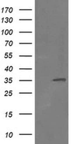 RFC2 Monoclonal Antibody (OTI2B2), TrueMAB , OriGene 30 &mu;L; Unconjugated:Antibodies,