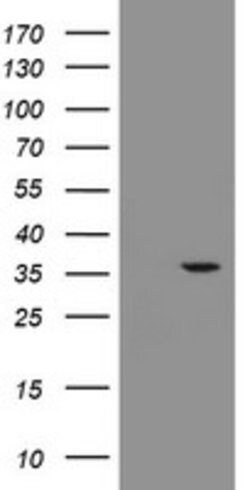 RFC2 Mouse anti-Human, Clone: OTI3F6, lyophilized, TrueMAB 100 &mu;g; Unconjugated:Antibodies,